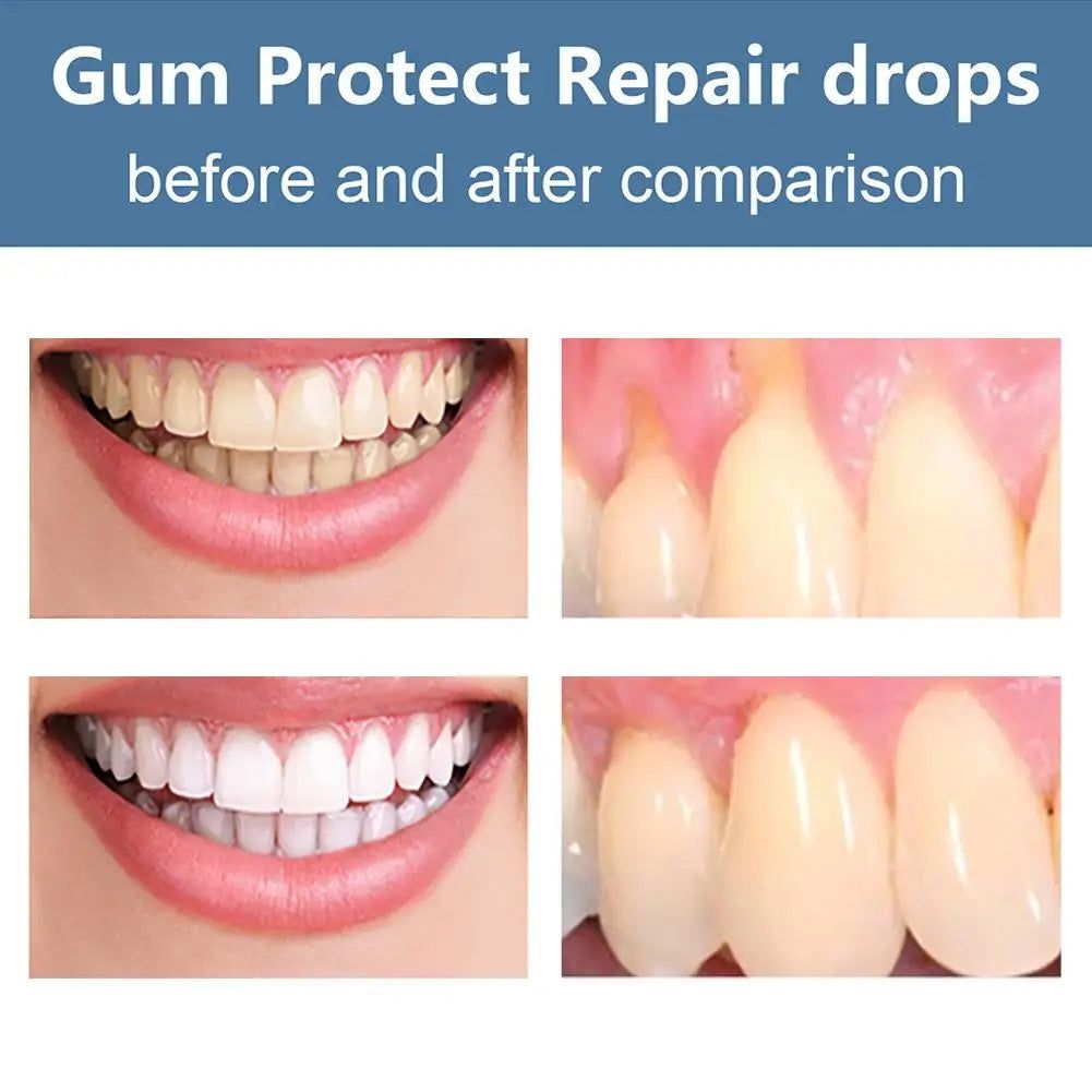 image-Eelhoe Gum Repair Serum Drops - 30ml Oral Care Solution