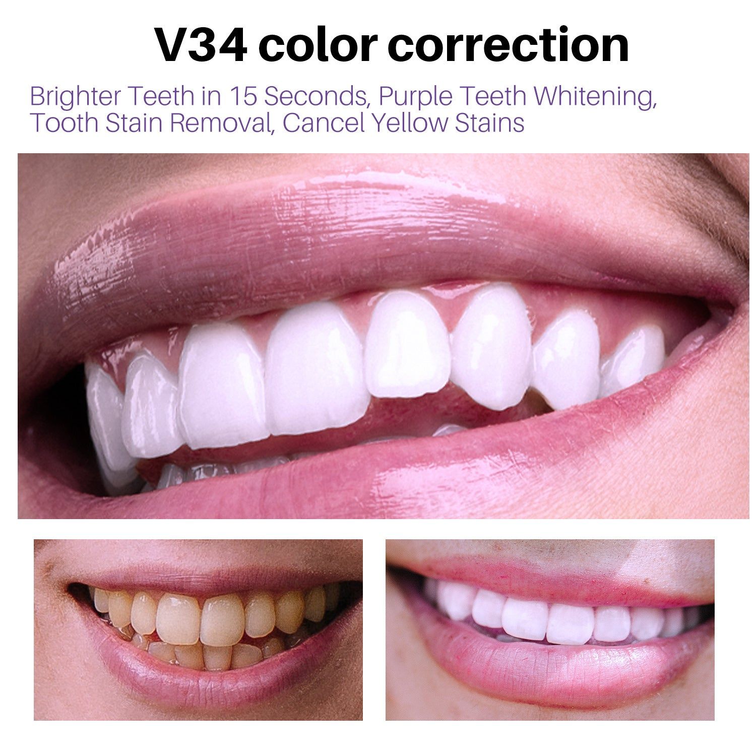 image-lanthome V34 Dental Mousse Teeth Whitening
