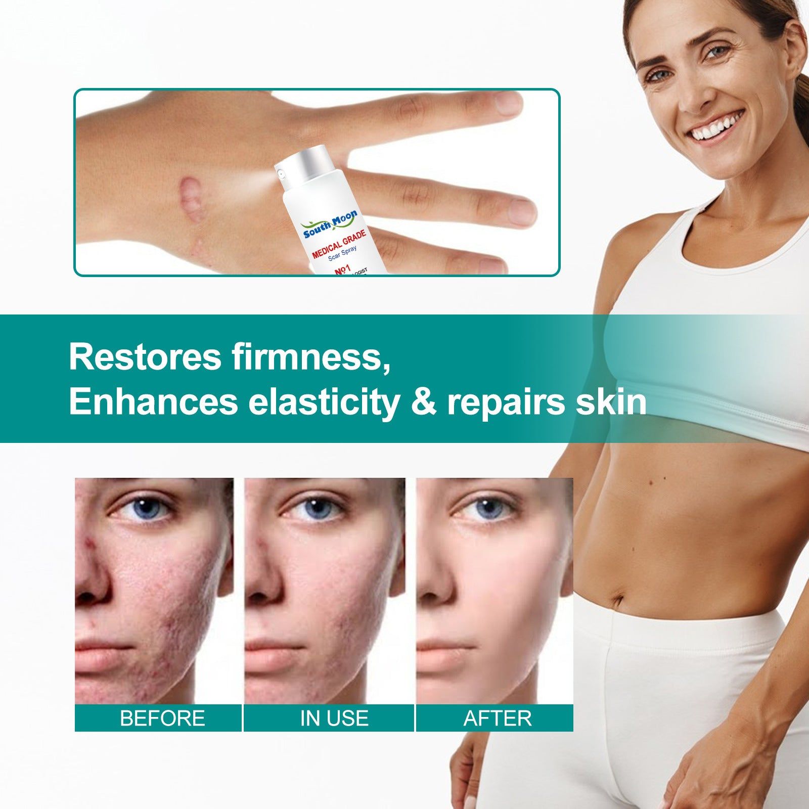 image-South Moon Scar Care Spray - Burn & Stretch Mark 