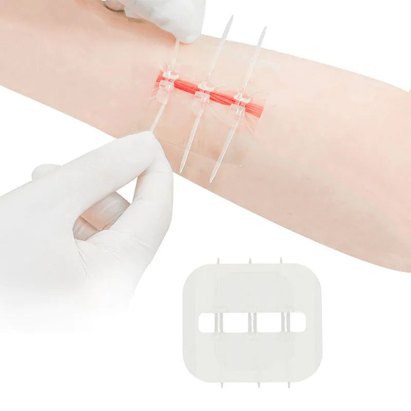 image-Offender Transparent PU Strap Wound Band-Aid - White Medium Soft