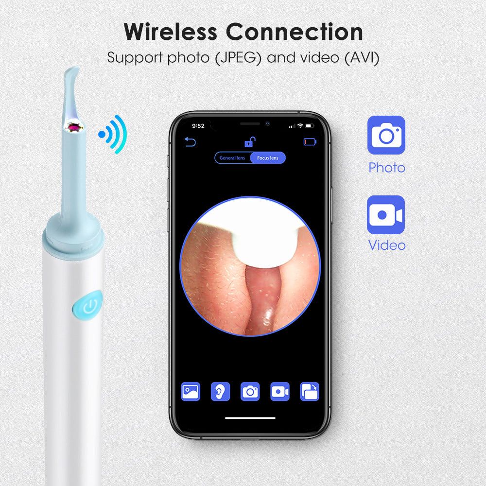 image-Intelligent Visual Ear Cleaning Spoon 500W Wireless HD